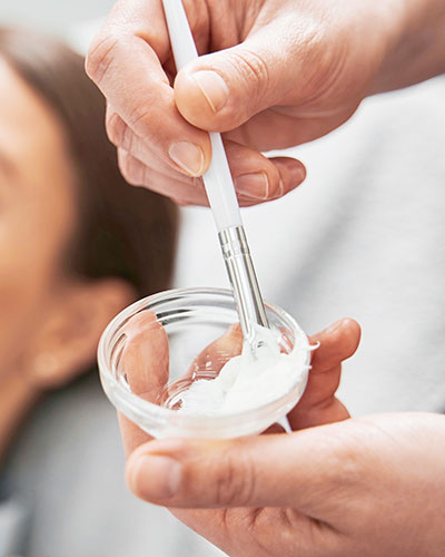 Peeling-chimici-vert